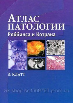 Атлас патології Роббінса та Котрана 2010г. Е. Клатт 499002 фото