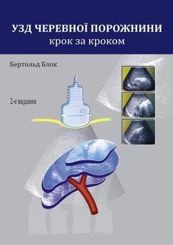 УЗД черевної порожнини. Крок за кроком Бертольд Блок 2-ге видання 3810391 фото