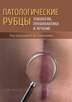 Патологічні рубці. Етиологія, профілактика та лікування Степанкіну С.Н. 2022г. 74792 фото