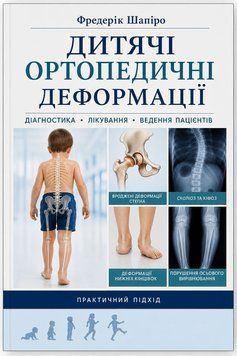 Дитячі ортопедичні деформації Фредерік Шапіро 329205023 фото