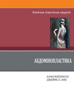 Клінічна пластична хірургія. Абдомінопластика. Алан Матарассо 2020р. 202939 фото