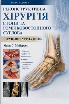 Реконструктивна хірургія стопи та гомілковостопного суглоба. Лікування ускладнень 3-тє видання Марк Майерсон 3590015 фото