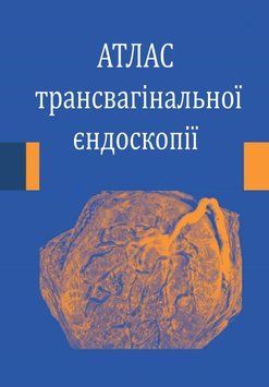 Атлас трансвагинальной эндоскопии Стефан Гордтс 594902 фото