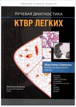 Променева діагностика. КТВР легких С. Мартінес-Хіменес М.Л. Троянда-де-Крістенсон Б.В. Картер 2022г. 2022500 фото
