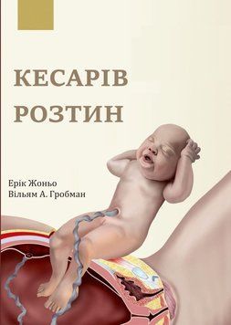 Кесарево сечение. Эрико Жено 2016г. 487591 фото
