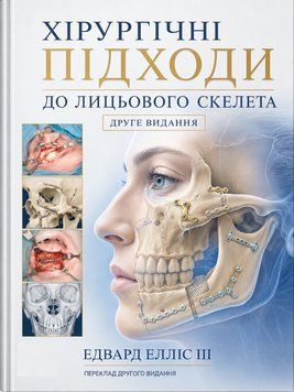 Хірургічні підходи до лицьового скелета. 2-ге видання Едвар Елліс 48929-987 фото