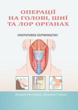 Операции на голове, шее и ЛОР органах. Оперативное руководство Джордж Моклоулис 380301 фото