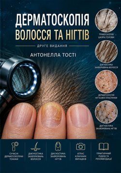 Дерматоскопия волос и ногтей Антонелла Тости 326232-67 фото