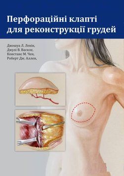 Перфораційні клапті для реконструкції грудей Джошуа Л. Левін 2016р. 7926533 фото