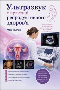 Ультразвук у практиці репродуктивного здоров'я Мері Піллай 2018р. 388992-34 фото