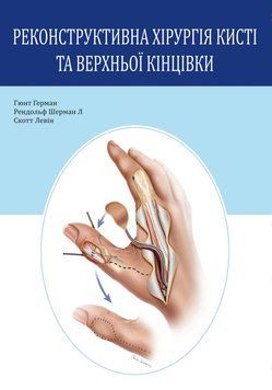 Реконструктивна хірургія кисті та верхньої кінцівки Гюнт Герман 2018р. 4801094 фото