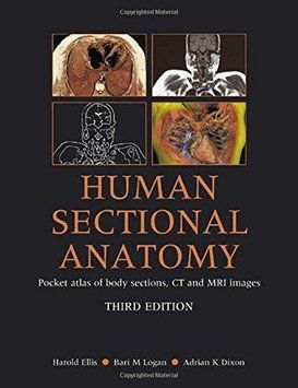Human Sectional Anatomy : Third Edition Atlas of Body Sections, CT and MRI Images 6793 фото