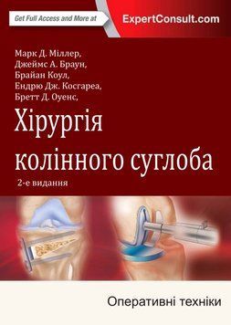 Хірургія колінного суглоба 2-ге видання. Оперативні техніки Марк Д. Міллер 2018р. 6056296 фото