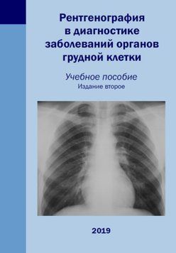 Рентгенография в диагностике заболеваний органов грудной клетки 2-е издание 2019г. 841352 фото