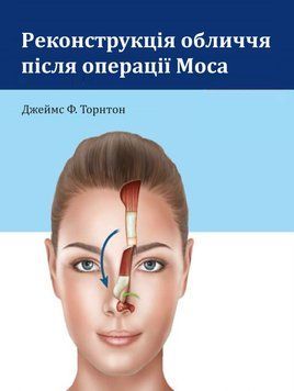Реконструкція обличчя після операції Моса. Джеймс Ф. Торнтон 2018р. 47692135 фото