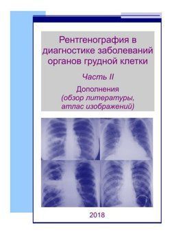 Рентгенография в диагностике заболеваний органов грудной клетки (часть 2) - Мельников В.В. 2018г. 765942 фото