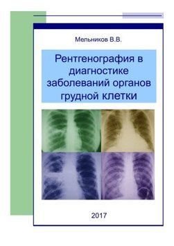 Рентгенография в диагностике заболеваний органов грудной клетки Мельников В.В. 2017г. 479523 фото