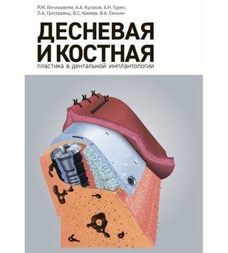 Деснева та кісткова пластики в дентальній імплантології Р. М. Беніашвілі 2017г. 67332 фото
