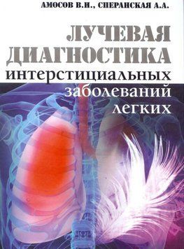 Променева діагностика інтерстиціальних захворювань легких Амосів В.І. 2015г. 20153 фото