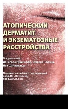 Атопический дерматит и экзематозные расстройства под ред. Дональда Рудикоффа 2017г. 76920 фото