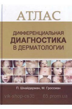 Атлас. Диференціальна діагностика в дерматології Шнайдерман П. Гросман М. 2017г. 2017422 фото