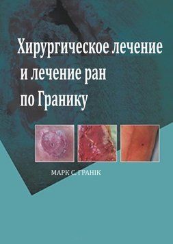 Хірургічне лікування ран по Граніку 2007р. 33896133 фото