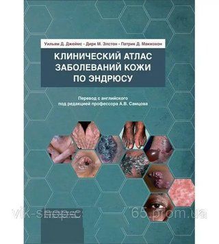 Клінічний атлас захворювань шкіри по Ендрюсу а43664 фото
