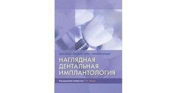 Наочна дентальна імплантація Мале Ж. Мора Ф. 2021г. 674922 фото
