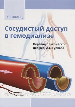 Судинний доступ у гемодіалізі Шольц Х. 2019г. 67492 фото