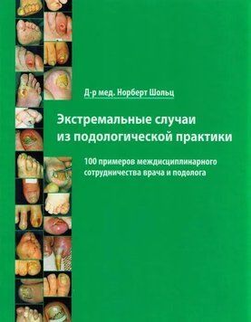 Екстремальні випадки з подологічної практики Норберт Шольц 2016г. 951133 фото
