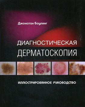 Диагностическая дерматоскопия Джонатан Боулинг 6782913 фото