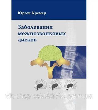 Захворювання міжхребцевих дисків. Ю.Кремер. В.А.Широків. 2013г. 5678 фото