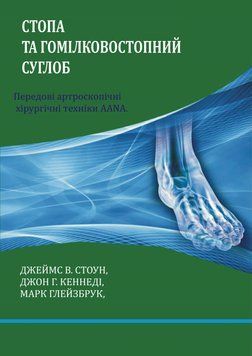 Стопа та гомілковостопний суглоб. Передові артроскопічні хірургічні техніки AANA. Джеймс В. Стоун 7868585 фото