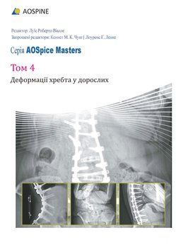AOSpine Masters Toм 4 Деформації хребта у дорослих Луїс Роберто Віалле 748252 фото