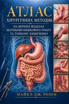 Атлас хірургічних методик на верхніх відділах шлунково-кишкового тракту та тонкому кишківнику Майкл Дж. Розен 4820244 фото