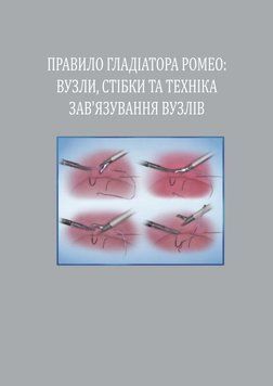 Правило Гладиатора Ромео: узлы, стежки и техника завязывания узлов 2013г. 977521 фото