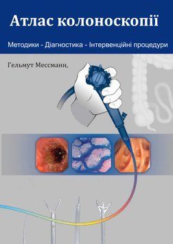 Атлас колоноскопии. Методики, диагностика, интервенционные процедуры. Гельмут Мессманн 3853001 фото