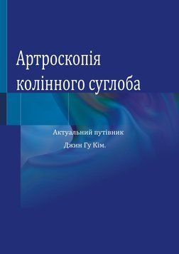 Артроскопия коленного сустава. Актуальный путеводитель Джин Гу Ким 758583 фото