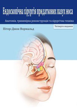 Ендоскопічна хірургія придаткових пазух носа. Анатомія, тривимірна реконструкція та хірургічна техніка Пітер-Джон Вормальд 4990204 фото