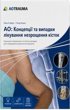 AO: Концепції та випадки лікування незрощення кісток Рене К Марті 759294000 фото