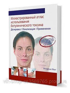Ілюстрований атлас ін'єкційного використання ботулінічного токсину Вольфганг Йост 93232 фото