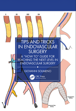 Tips and Tricks in Endovascular Surgery: A "How to" Guide for reaching the next Level in Endovascular Surgery (Поради та рекомендації по ендоваскулярній хірургії) 590224 фото