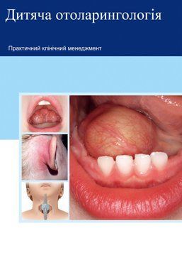 Детская отоларингология. Практический клинический менеджмент 6492445 фото