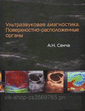Ультразвукова діагностика. Поверхнево-розміщені органи Сенча А.Н. 2015г. 2125 фото
