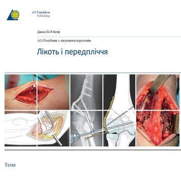 AO: Посібник з лікування переломів. Лікоть і передпліччя.  Джессі Бі Юпітер 5878924-656 фото