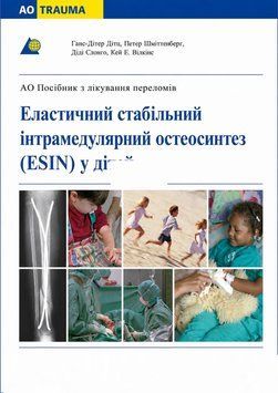 AOTrauma: Еластичний стабільний інтрамедулярний остеосинтез (ESIN) у дітей  Ганс Ґеорґ 895003 фото