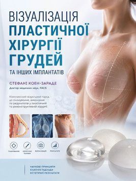 Візуалізація пластичної хірургії грудей та інших імплантатів  Стефані Коен-Зараде 2022р. 5682-12 фото