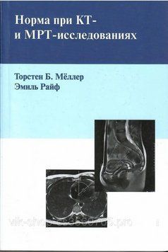 Норма у разі КТ- та МРТ- дослідженнях МЕллер Т.Б. 75912 фото