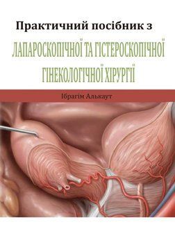 Практичний посібник з гістероскопічної гінекологічної хірургії. Ібрагім Алькаут 2020р. 3039913 фото