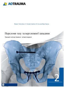 Переломи тазу та вертлюжної западини 2 том. Принципи і методи лікування 4-те видання Марвін Тайл, Девід Л. Хелфет 7592111 фото